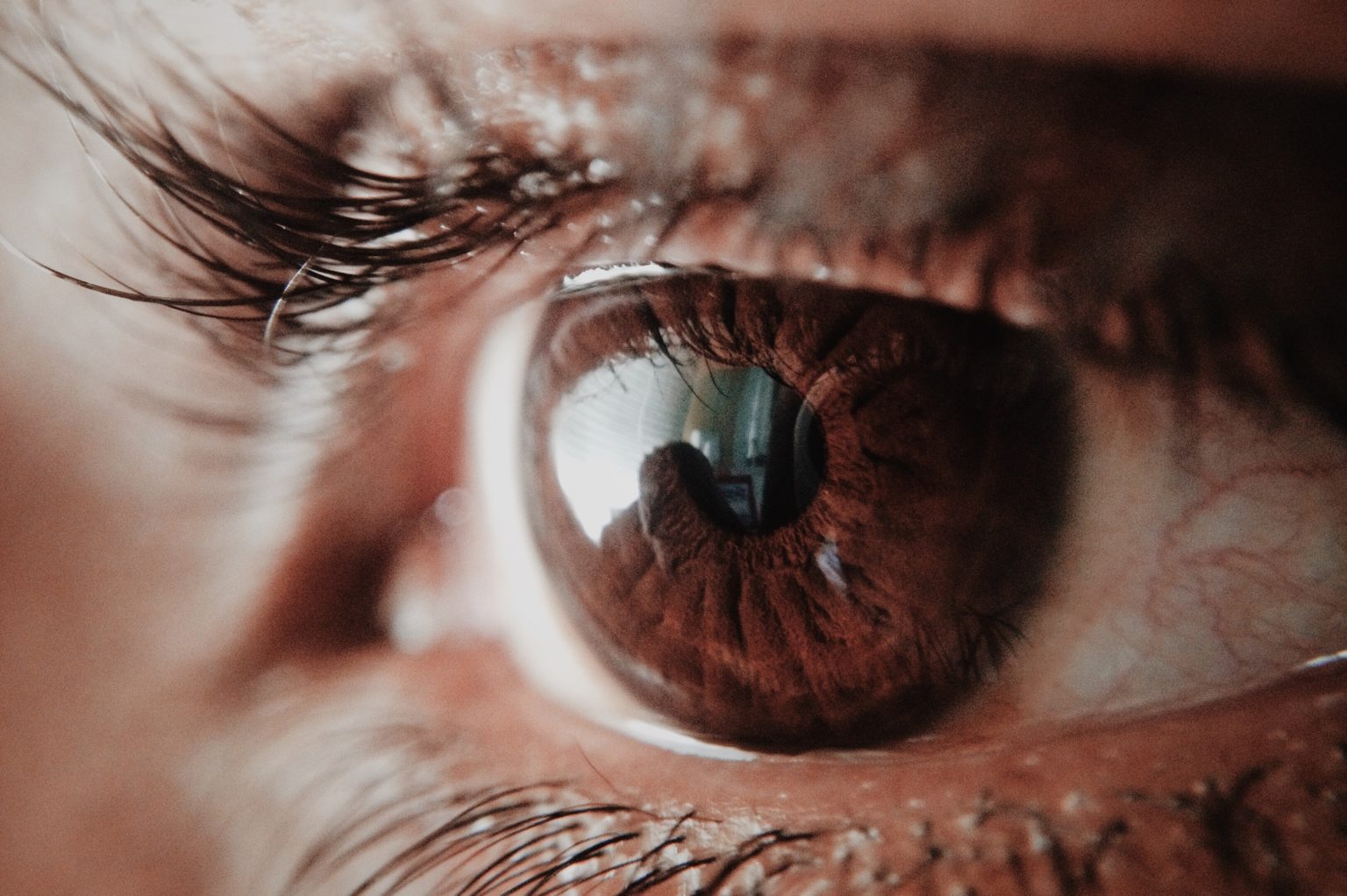 How Long Does Cataract Surgery Recovery